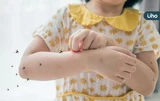為什麼蚊子喜歡叮小孩？醫揭「8類人」易招蚊蟲叮咬：小孩佔一半條件
