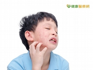 皮膚過敏癢又痛 免疫失衡怎麼辦?