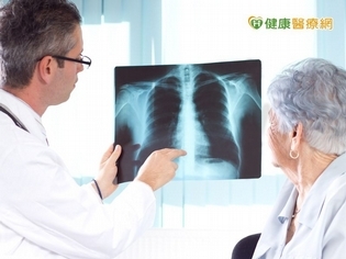 肺癌致死率七年第一!新款標靶療效亮眼