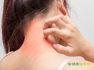 異位性皮膚炎退散!「濕敷療法」最速效