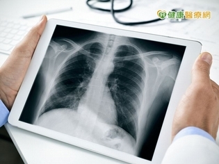 警覺易忽略的腰痛!恐因肺癌骨轉移