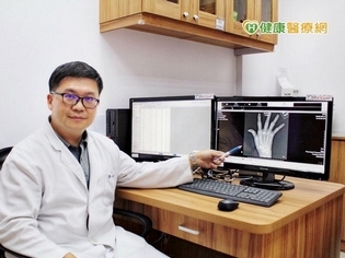 手指關節疼痛別輕忽 小心類風濕性關節炎上身