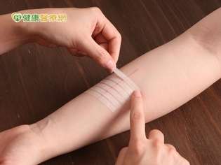 害怕術後長出蜈蚣疤?醫師教你正確護理事半功倍