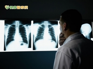 腰痠背痛好不了?恐是肺癌骨轉移作怪
