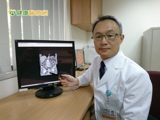 30歲女性有血尿以為感染 沒想到竟罹癌!