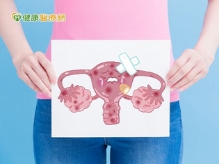 妙齡女郎腰變粗 竟因晚期卵巢癌作怪