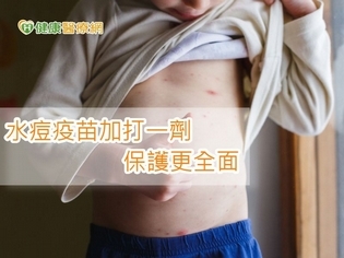 初春好發水痘 醫:兒童補一劑提升保護力