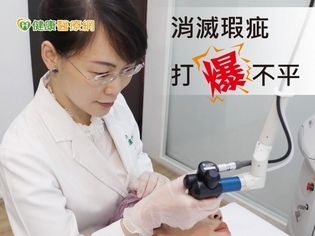 痘疤燒燙疤有救 醫學雷射UP再升級