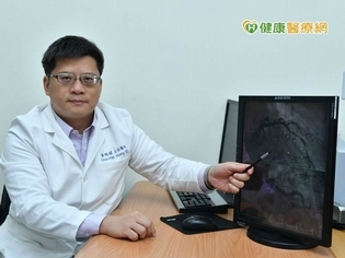 壞膽固醇頻頻塞血管 用藥降脂續命
