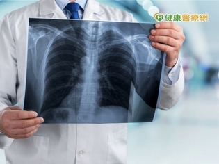 41歲男不菸竟肺癌 免疫治療病況穩