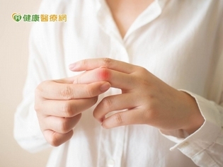 3徵兆恐是乾癬性關節炎作亂 醫:提防關節變形謹記336