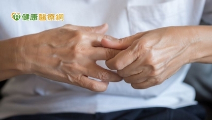 乾癬性關節炎不敢「輕舉妄動」! 小心反釀關節僵化攣縮