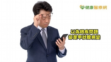 配老花「看走眼」!原來是甲狀腺造成眼病變