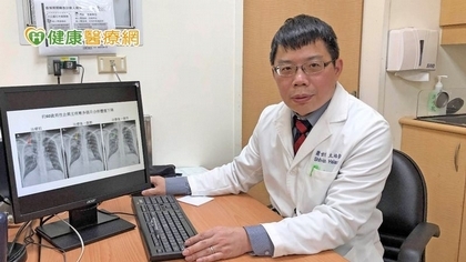 肺癌新一代ALK標靶納健保 無惡化存活期1年增至近3年