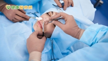 二次隆鼻手術專業醫美團隊分工「重建」自信心!