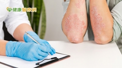 世界乾癬日:兼顧皮表乾癬與併發症落實全方位健康管理