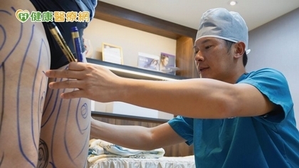 擺脫憔悴乾癟! 臉部補脂還你富貴「好命臉」