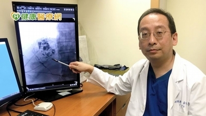 肝動脈碘油化療栓塞降期治療 提高患者生活品質!