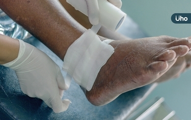 慢性傷口該怎麼照顧?整形外科醫師教你正確「處理關鍵」