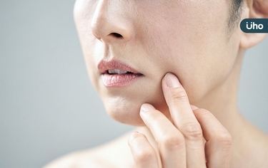 突然長「痣」不痛不癢藏危機?醫提醒「觀察7點」提前揪出皮膚癌