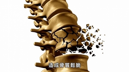 不想老來骨質疏鬆,你開始預防了嗎?【優活小講堂】