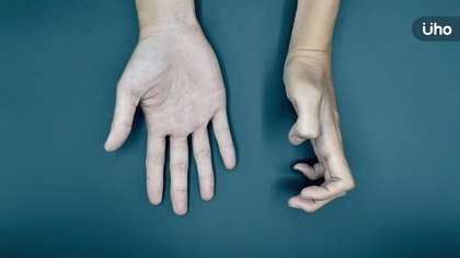 三好微電影國際競賽 脊髓性肌肉萎縮症微電影《等待.奇蹟》取佳績