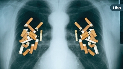 後疫情時代全民肺健康意識抬頭　胸重學會訂11月為肺功能檢測月
