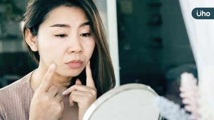 女生最在意臉型問題:嘴邊肉、木偶紋…醫親解「埋線」拉提真相