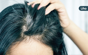 常染髮會致癌嗎？如何保養才不容易長白髮？皮膚科醫師這樣說⋯