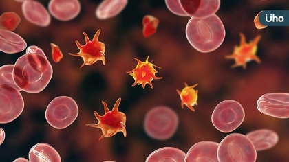 標靶藥救命!75歲急性血癌患者不住院治療也能成功抗癌