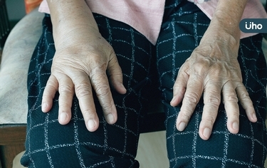 洗腎能治療腎?抽血無法驗出腎異常?醫揭「你不知道的25個腎真相」