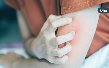 皮膚搔癢難解⋯竟是長新冠導致!中醫建議「喝這款」解毒茶飲緩解