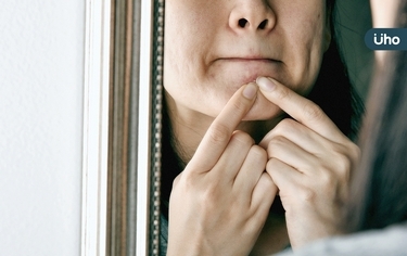 臉上凸起「一粒」竟不是痘痘!醫揭「表皮樣囊腫」特徵、症狀與治療