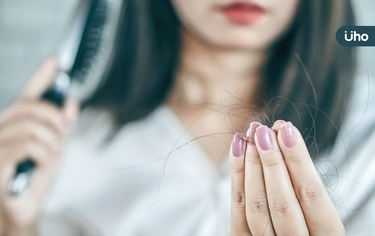 「細髮」女生會好命?誤會大了!醫警告「1狀況」出現恐面臨禿頭
