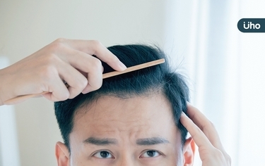 改善掉髮靠「精油按摩」也有用！營養師「5方法助生髮」從營養做起