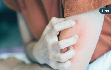 我該打帶狀疱疹疫苗嗎?「2種疫苗」哪一種適合我?醫教你這樣挑⋯