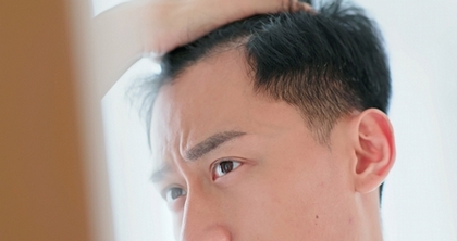 甜食導致掉髮?研究顯示落髮與含糖飲料攝取有關