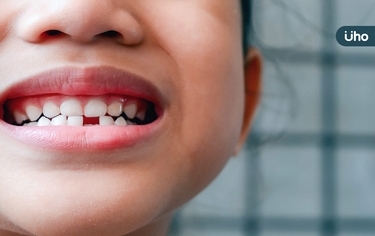 高低肩、駝背竟跟牙齒有關?我家小孩要口腔矯正嗎?醫揭3評估方式