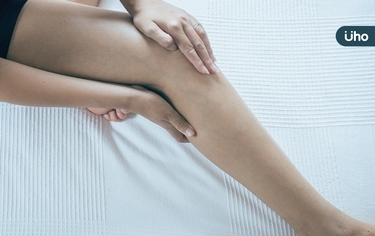 小腿腫脹、顏色變深、皮膚變硬⋯?醫揭「動脈壓迫靜脈」恐怖真相