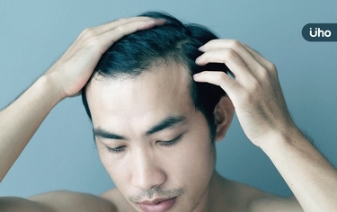 我有雄性禿嗎?醫揭3指標自我檢查:發現髮量稀疏「恐已落髮5成」
