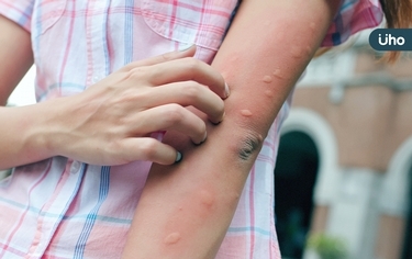 登革熱近3千例》登革熱預防6招快學起來!出現「這些症狀」恐重症示警