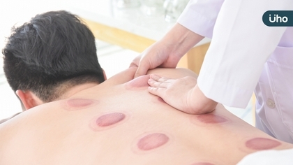 從刮痧看減重:中醫師如何解讀顏色深淺