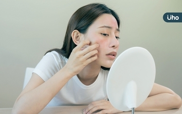 酸類煥膚卻泛紅、爆痘樣樣來?醫點名酸類保養「3地雷」防越煥越糟