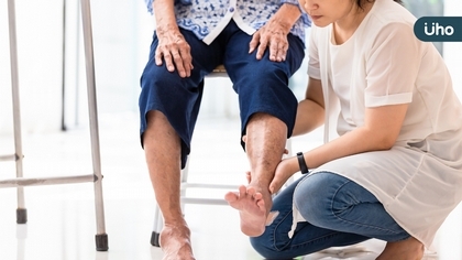 小腿冰冷、脫毛竟與中風有關?醫:周邊動脈阻塞影響血流,誤診恐截肢