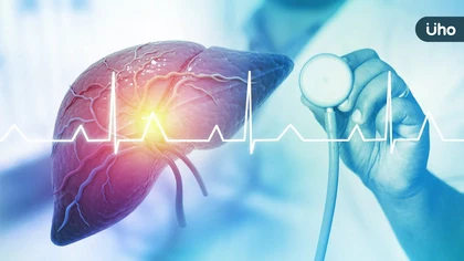 降期治療法+載藥微球栓塞,新治療策略讓晚期肝癌患者有機會換肝重生