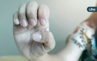 指甲凹陷、變黃正常嗎？指甲「8種變化」洩健康危機：1徵兆恐罹癌