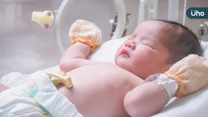 寶寶出生的喜悅,別讓「新生兒黃疸」來攪局!