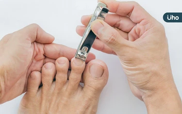 甲溝炎會自己好嗎？醫教「正確剪指甲技巧」剪平不剪短：最少留●●公分