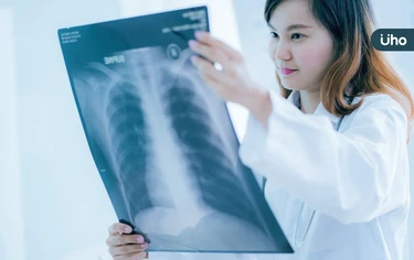 肺癌篩檢發現「肺部小結節」怎麼辦?醫列「4種情況」有機會自己消失