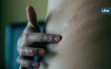 糖友注意!秋冬「皮蛇纏身」風險高●●倍,醫呼籲:優先做1事可預防